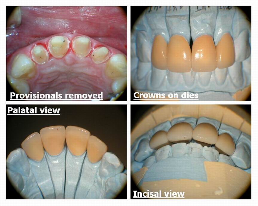 Resize of Crown insertion Derek Delong pg 2.jpg